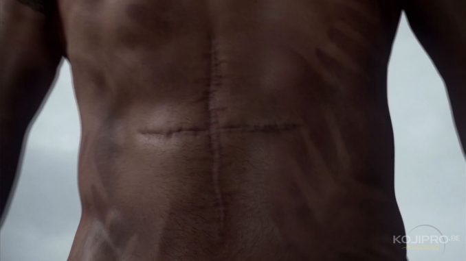 Norman Reedus a une grande cicatrice en forme de croix à la place du nombril